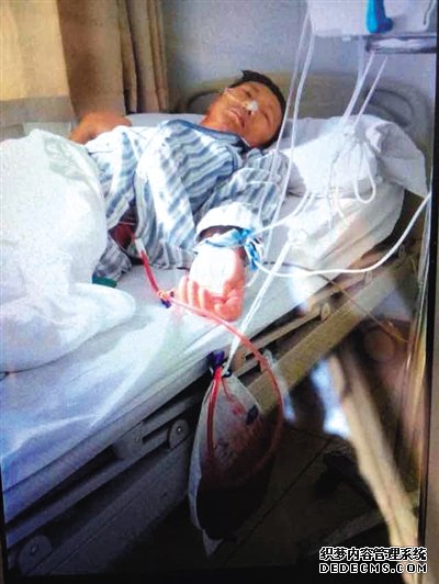 北京306医院，于尚清躺在病床上，身上插满管子，靠呼吸机、血泵等维持生命。家属供图